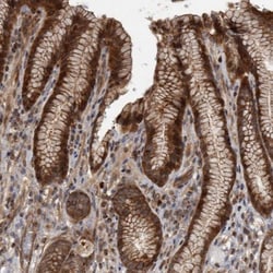 XKR6 Antibody, Novus Biologicals 25 &mu;L; Unlabeled:Antibodies, Polyclonal